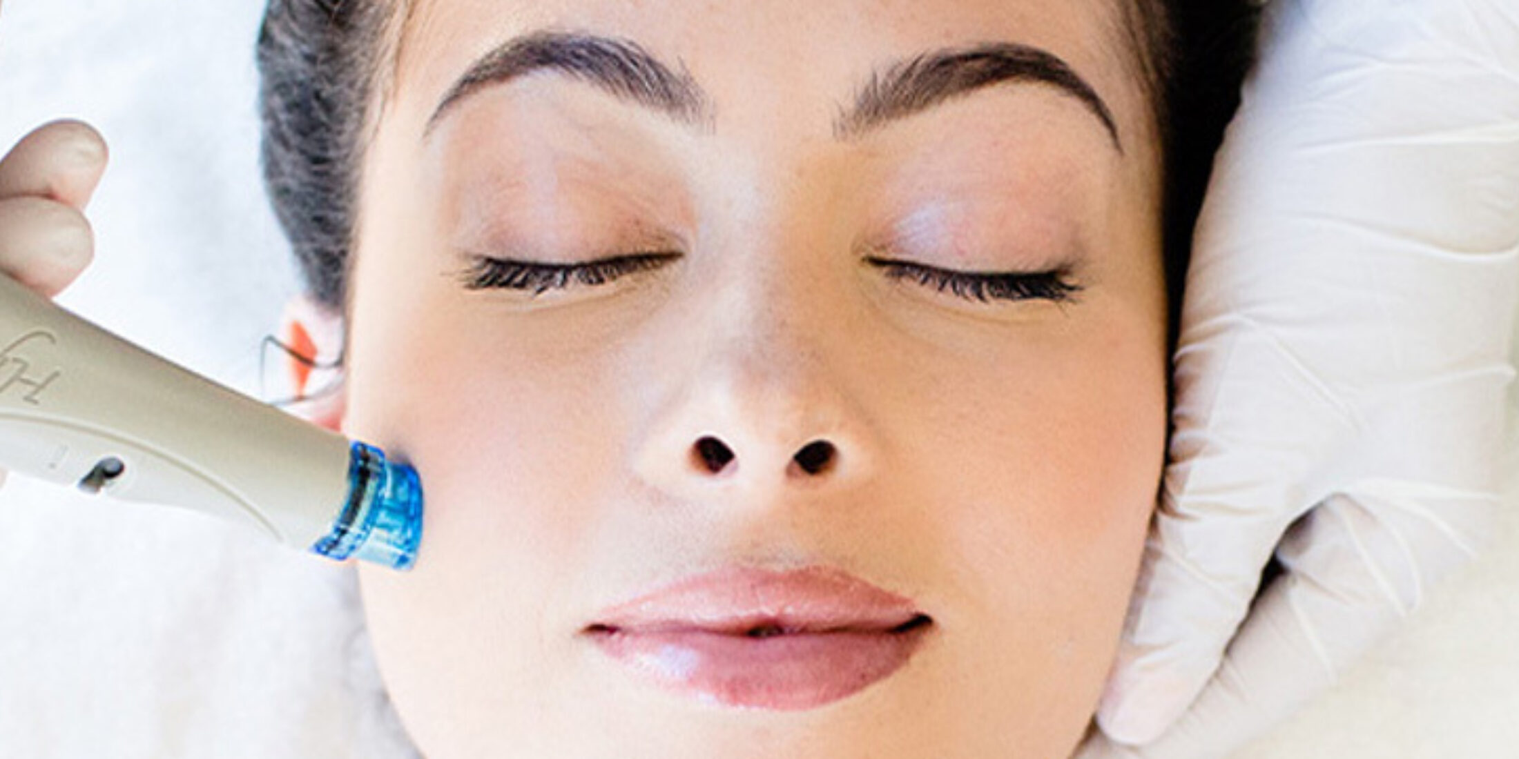 Hydrafacial 1